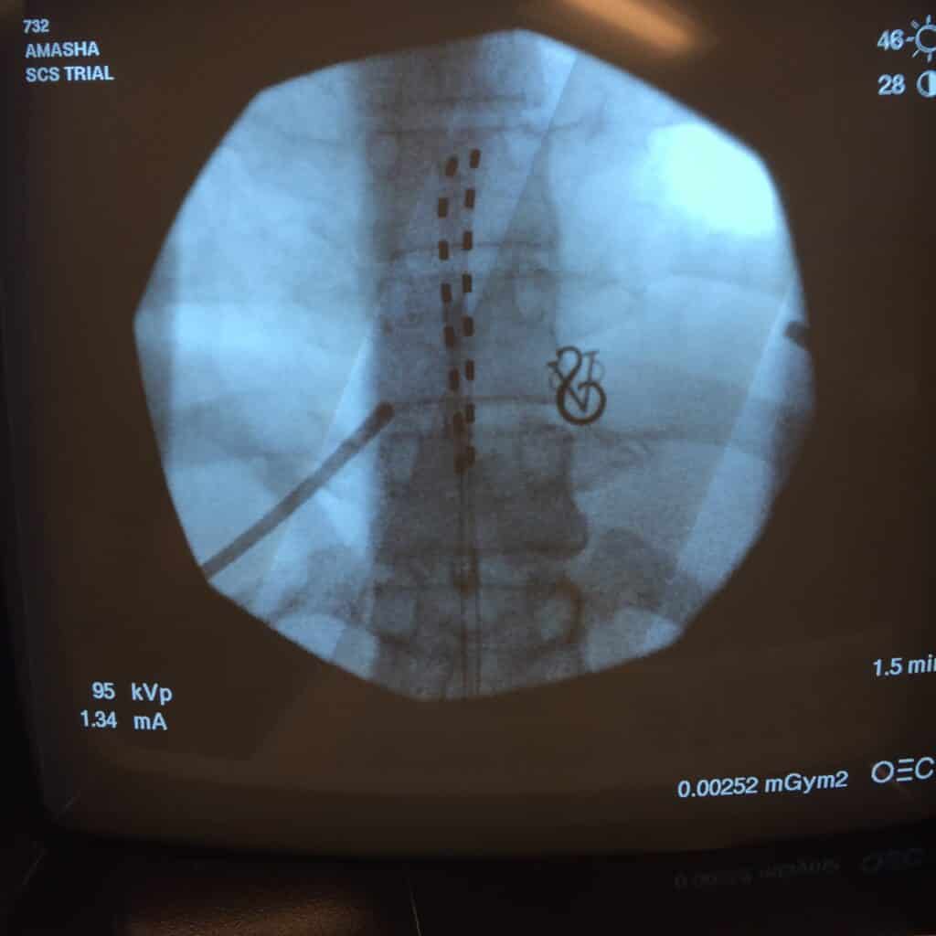Scan of Janet jay's spine, janetjay.com