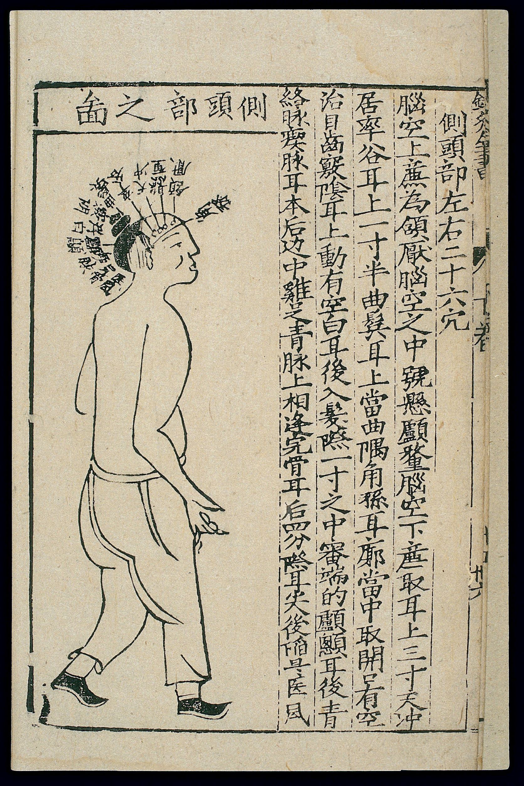 Acupuncture chart: side of the head, Chinese woodcut.